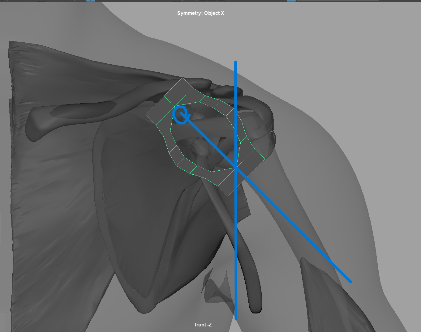 3D maquette of incision window