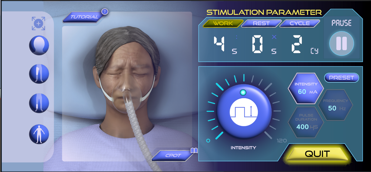 Patient's Discomfort caused by High Intensity (60mA~)