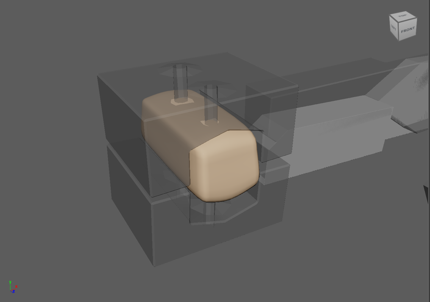 3D maquette of coracoid drill guide 003