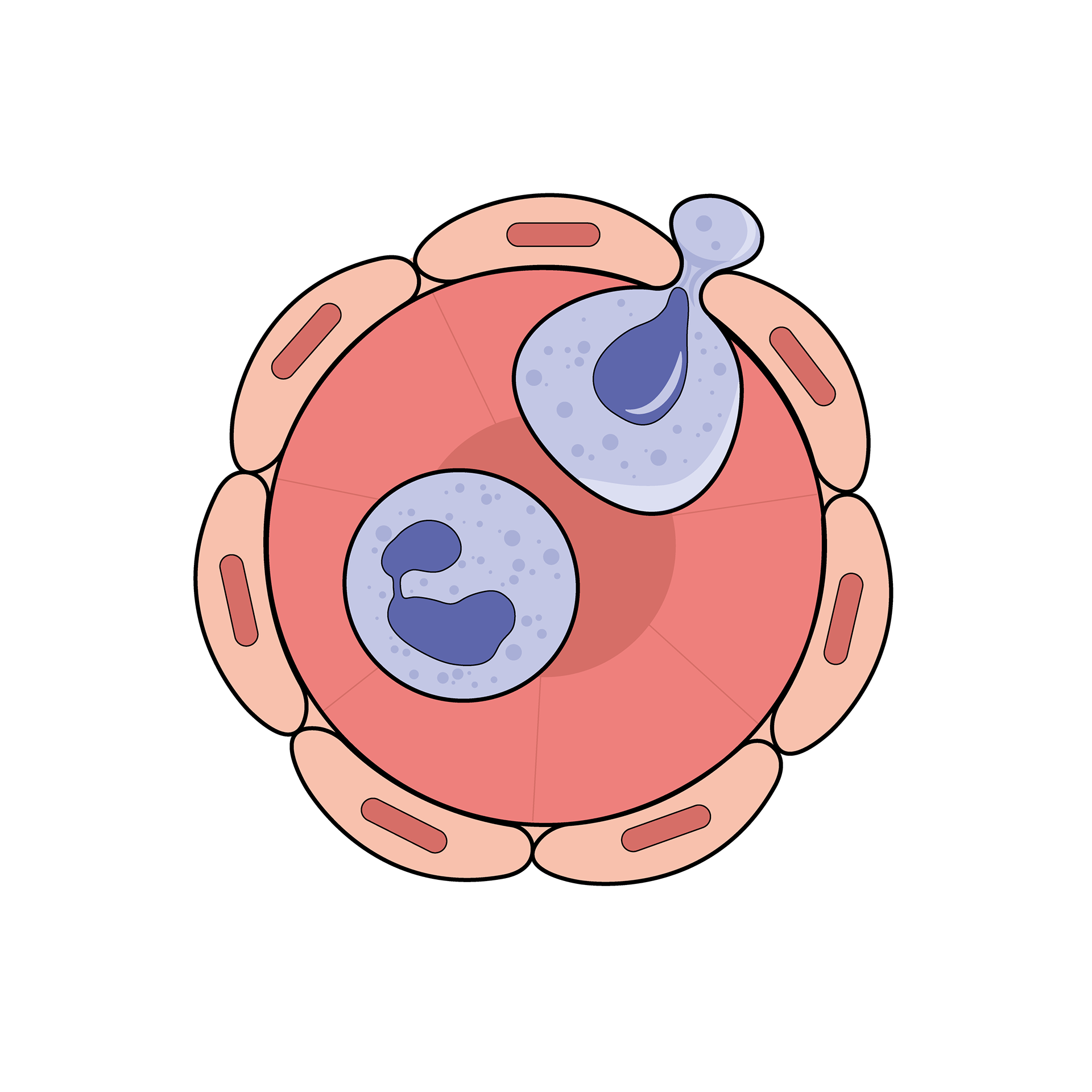 Inflammation