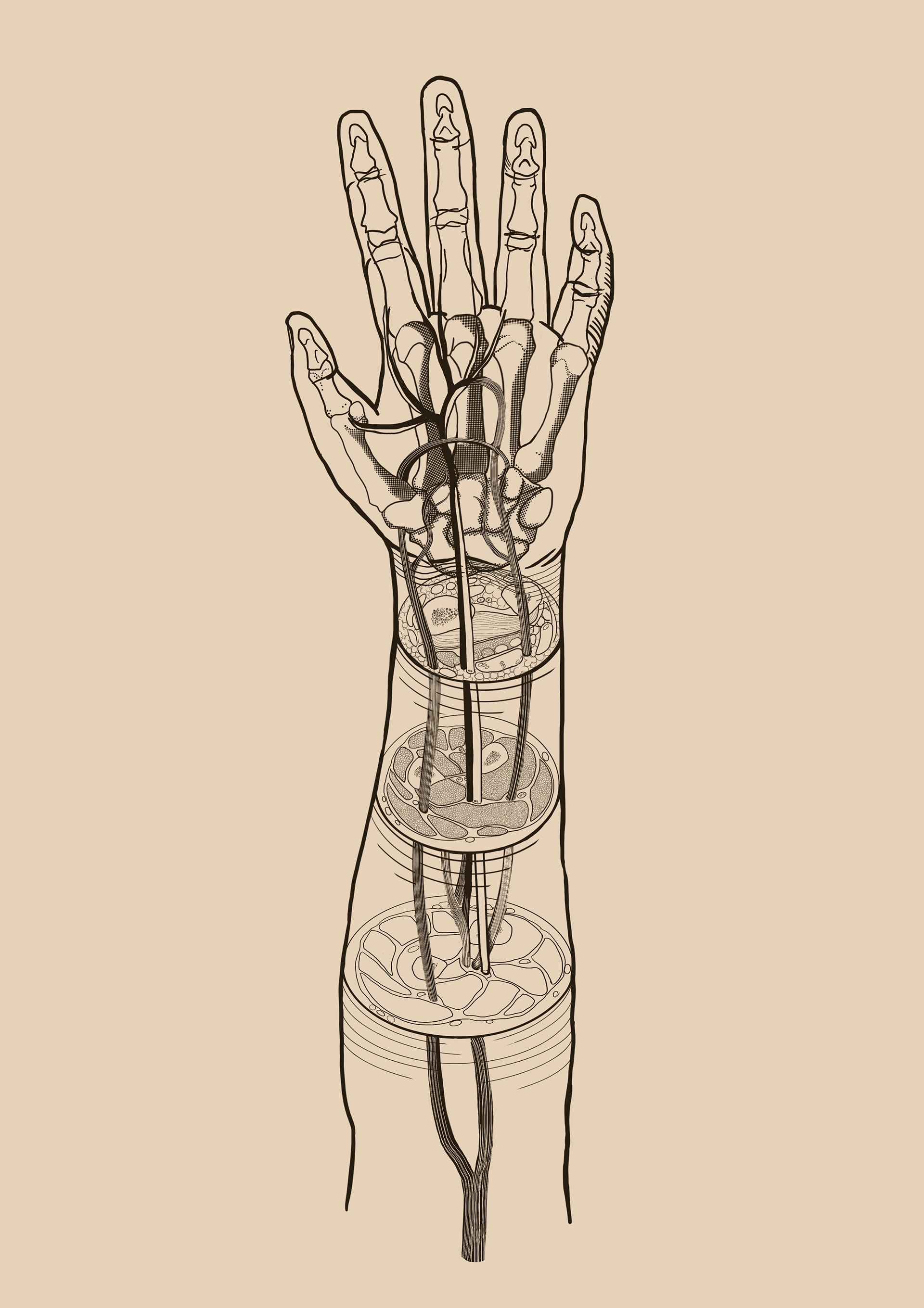 Median Artery_Sketch3