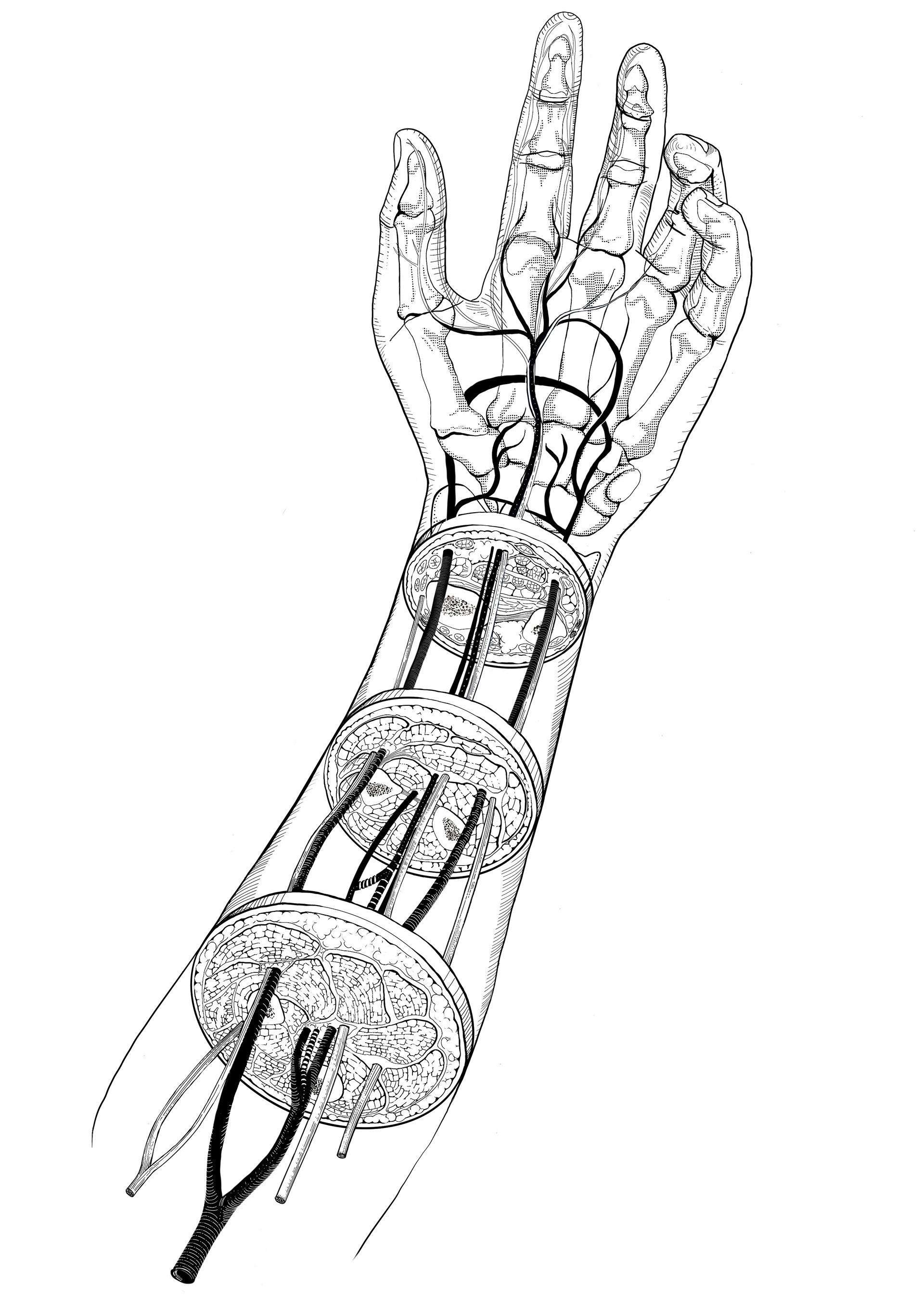 Median Artery_Sketch5