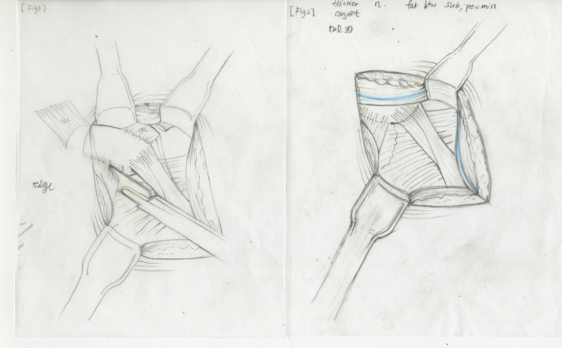 Thumbnail sketches 003
