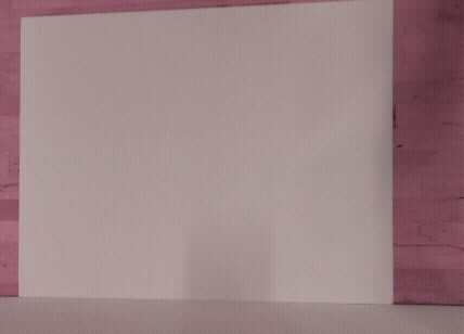 Neuroplasticity and Tunnel Vision (Pink), 2022