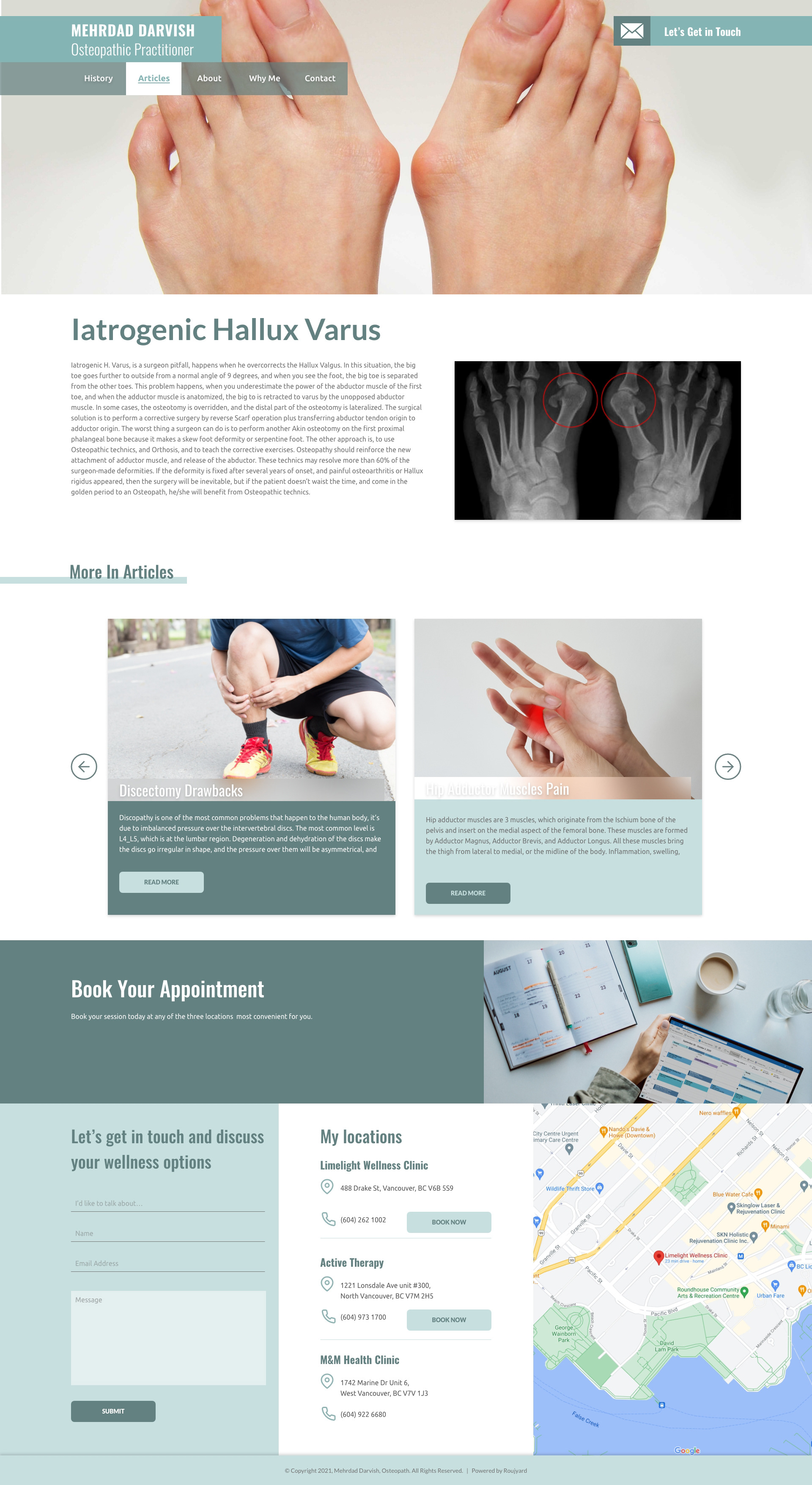 Article Page Hallux Varus