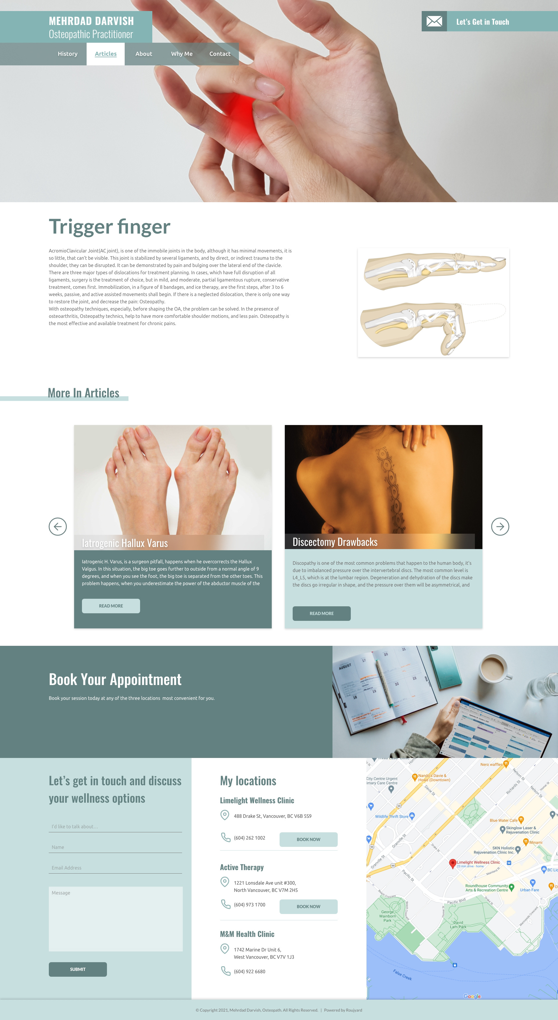 Article Page Trigger Finger