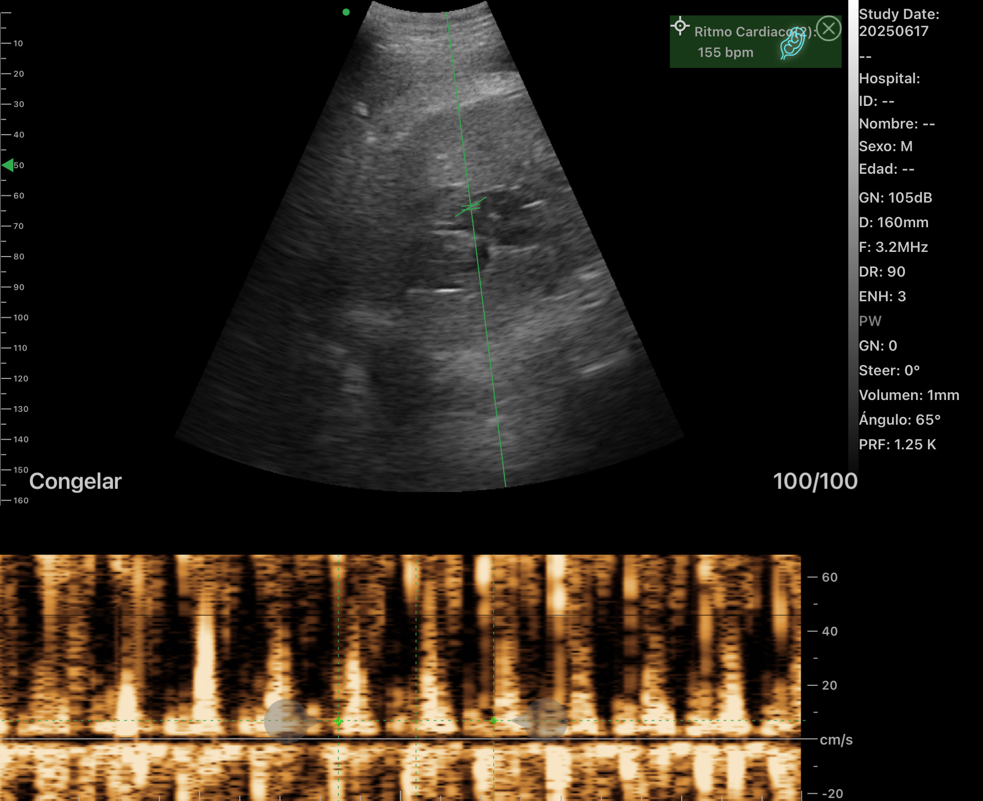 Cálculo_frecuencia_cardíaca_fetal