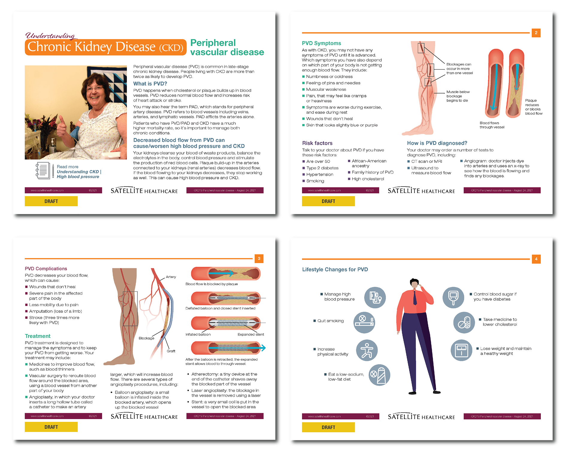 Peripheral Vascular Disease Flyer
