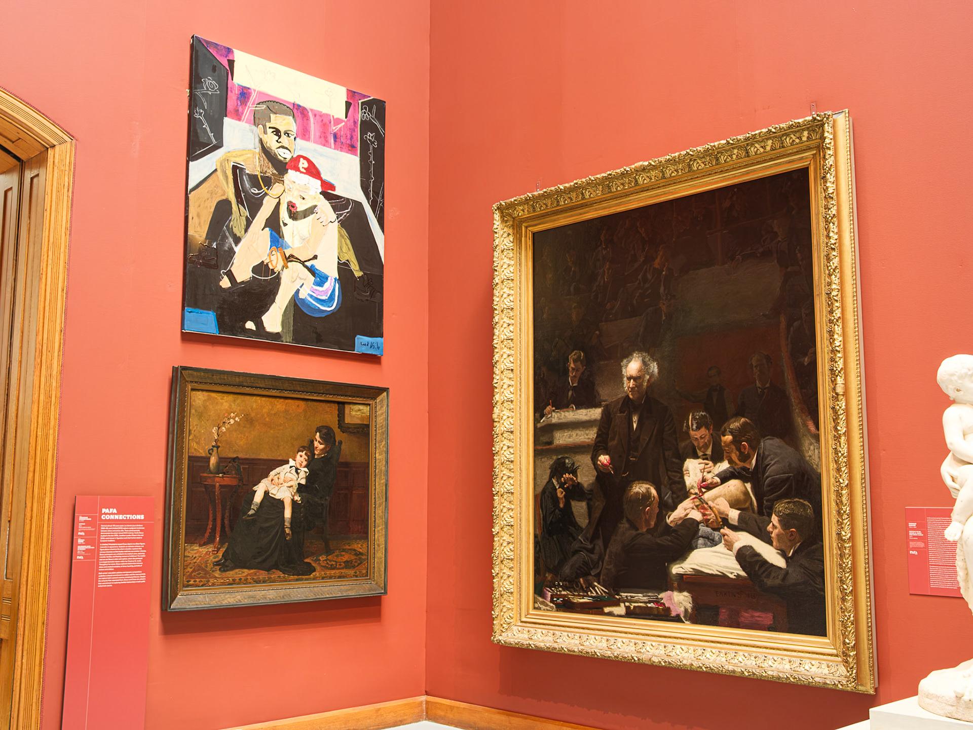 A Corner at Pennsylvania Academy for the Fine Arts Featuring Eakins' Gross Clinic