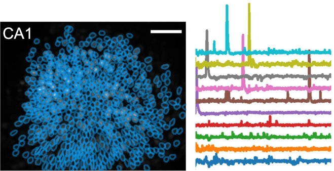 example hippocampal calcium imaging