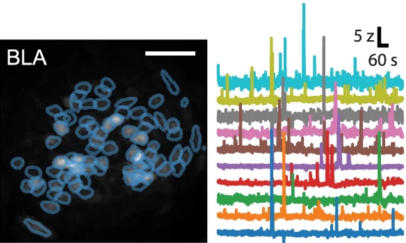 example amygdalar calcium imaging