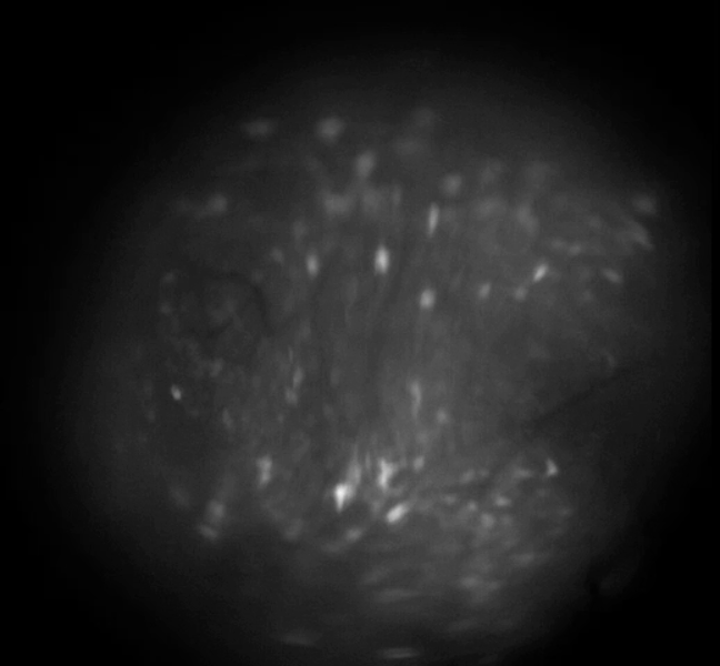 Example calcium imaging recording