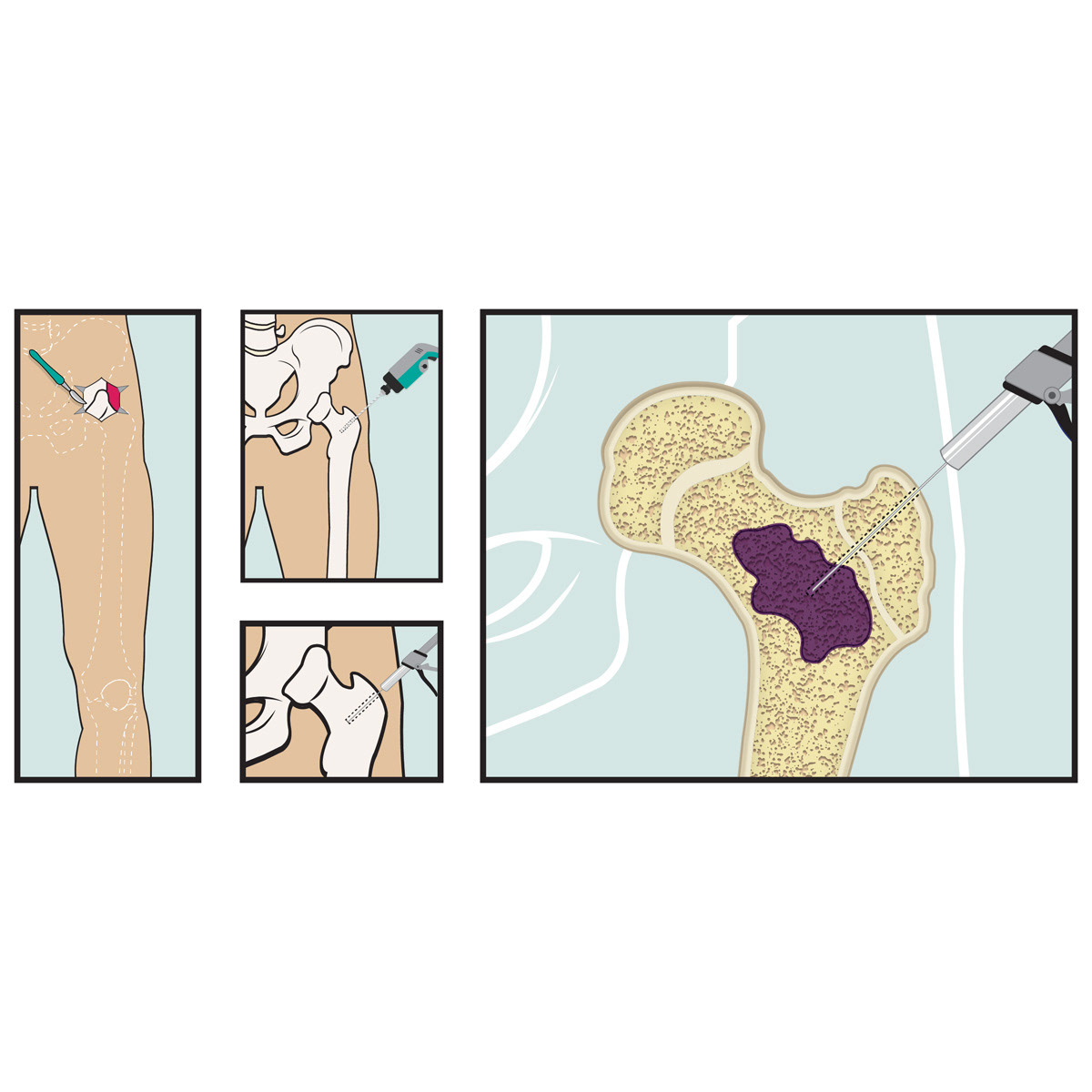 Medical Illustration for Research Grant