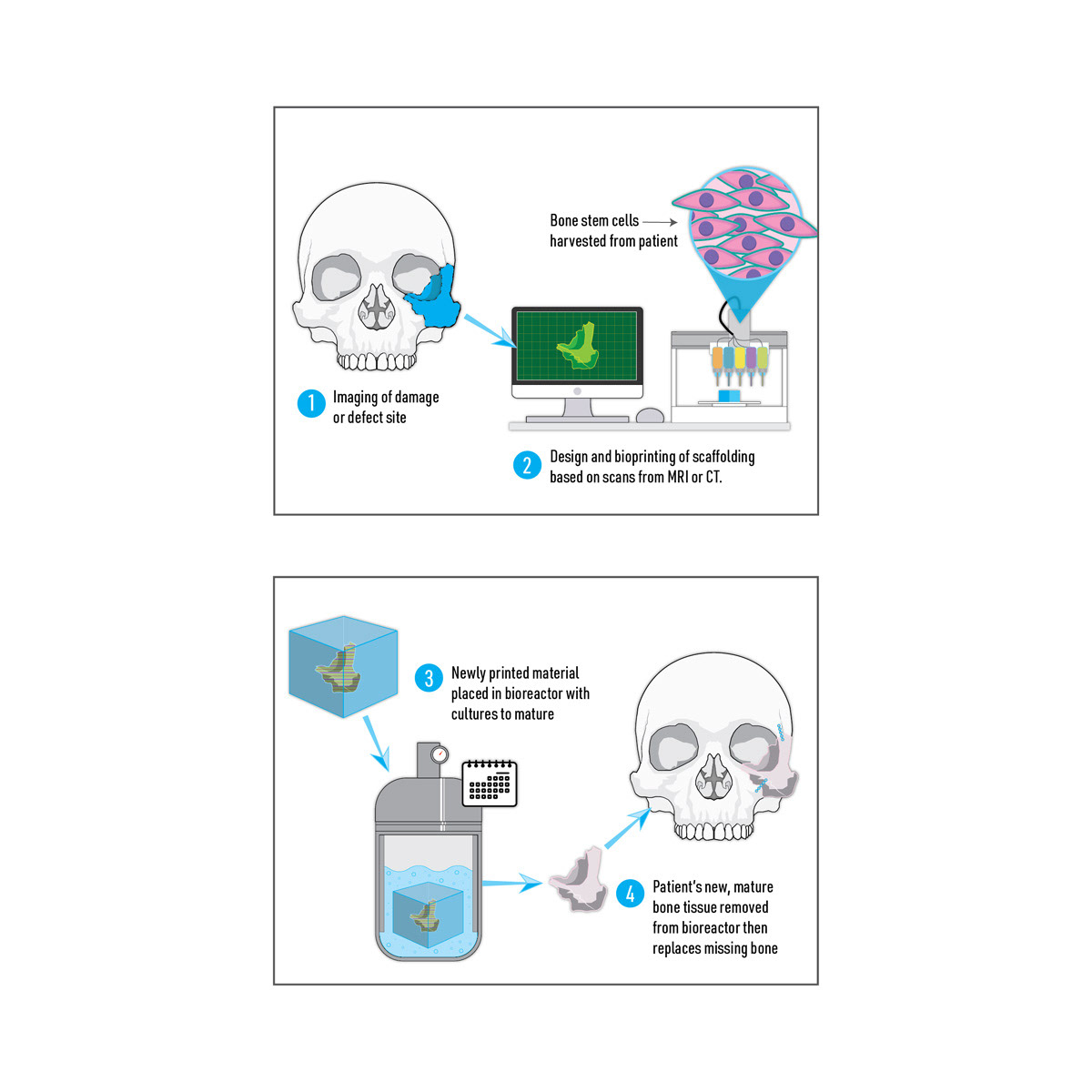 Medical Illustration for Research Grant