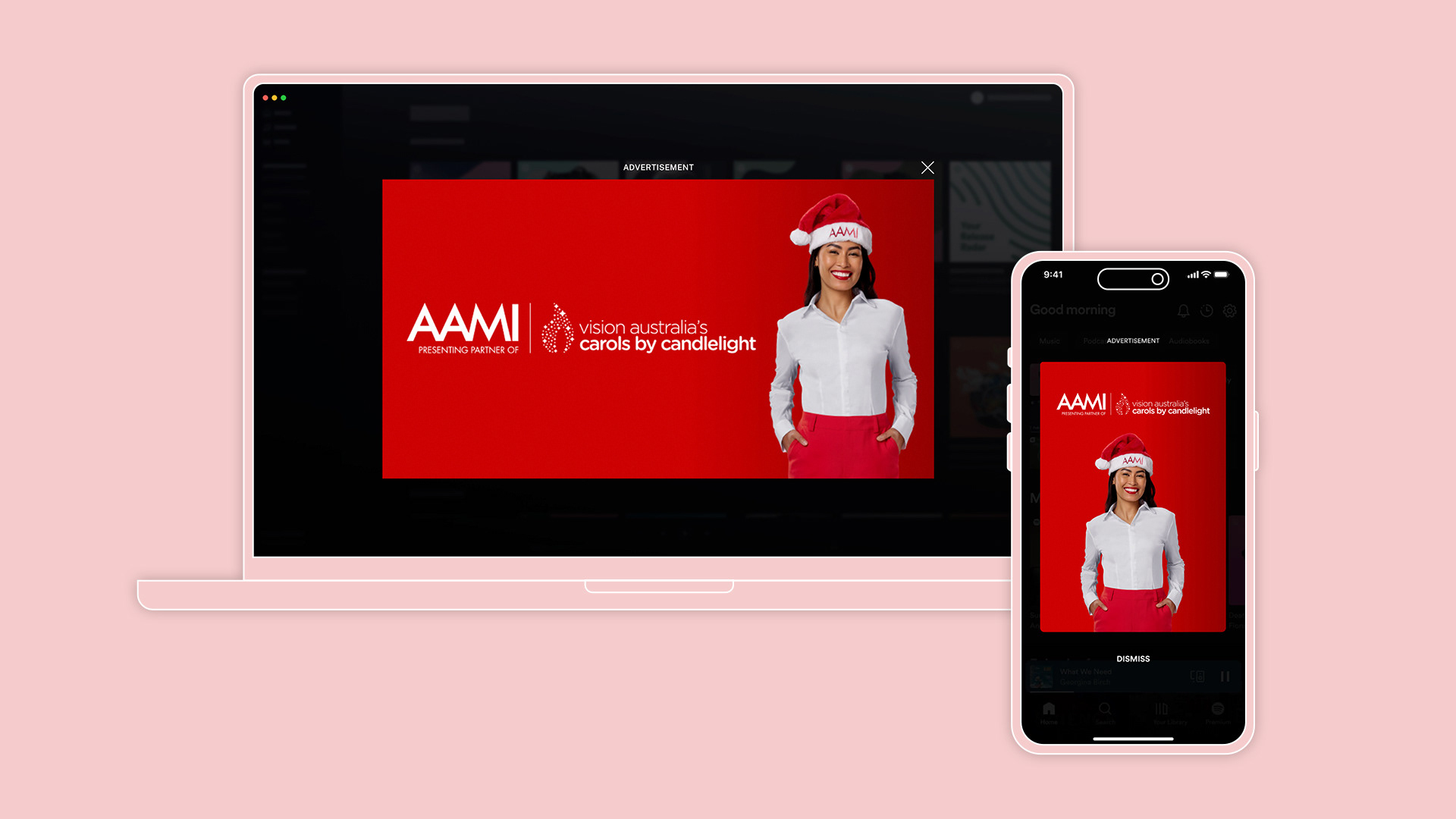 Spotify Native Overlays