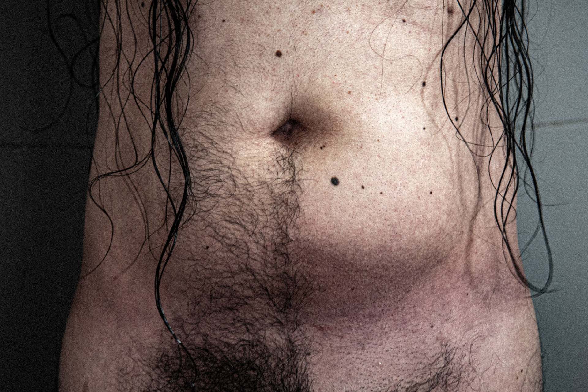 Para hablar de los pelos con EAE