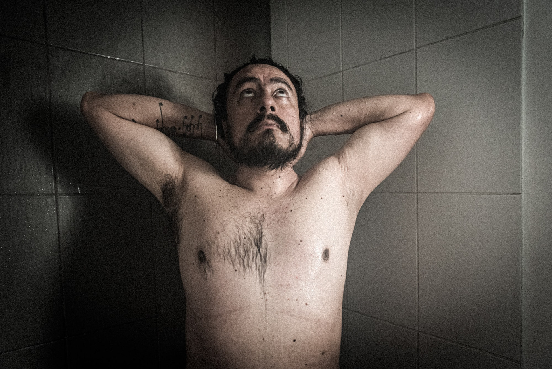 Para hablar de los pelos con EAE