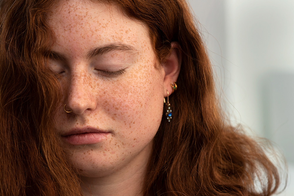 Sydney - Freckles