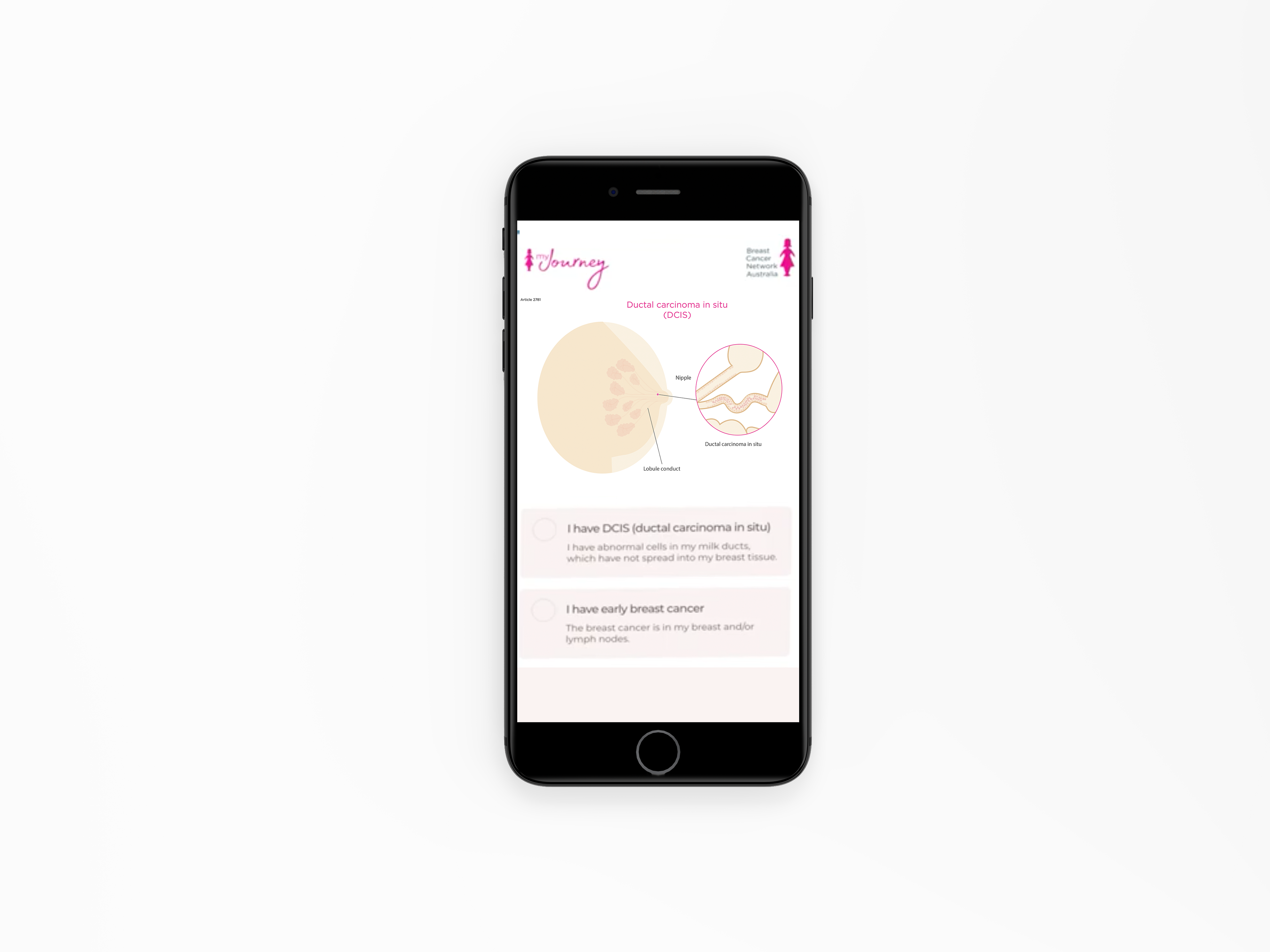 Technical Illustration -My Journey app