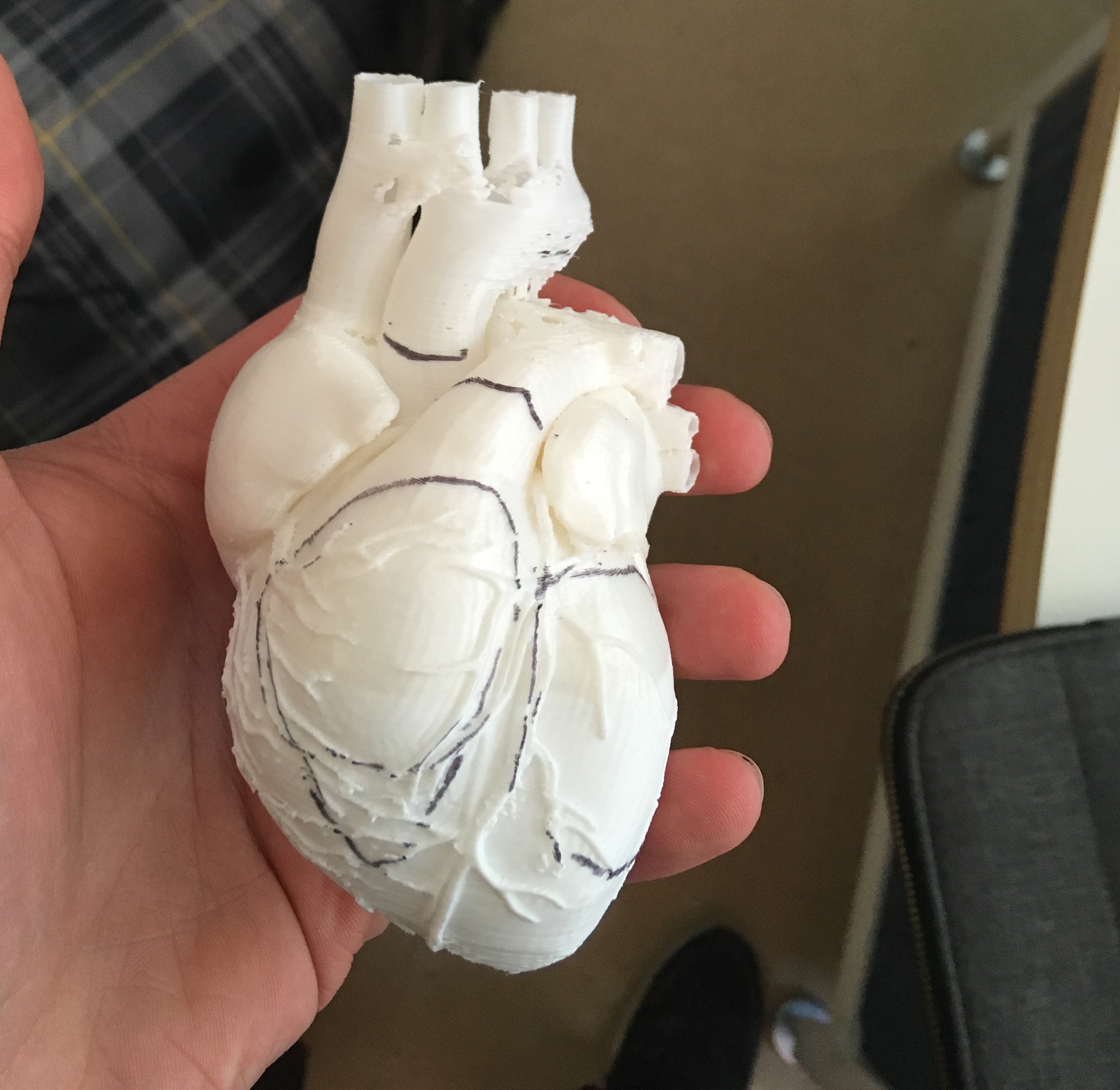 An early 3D print taken from a free 3D model online. We used this as an object to interview residents to ask where they wish they could see into the heart.