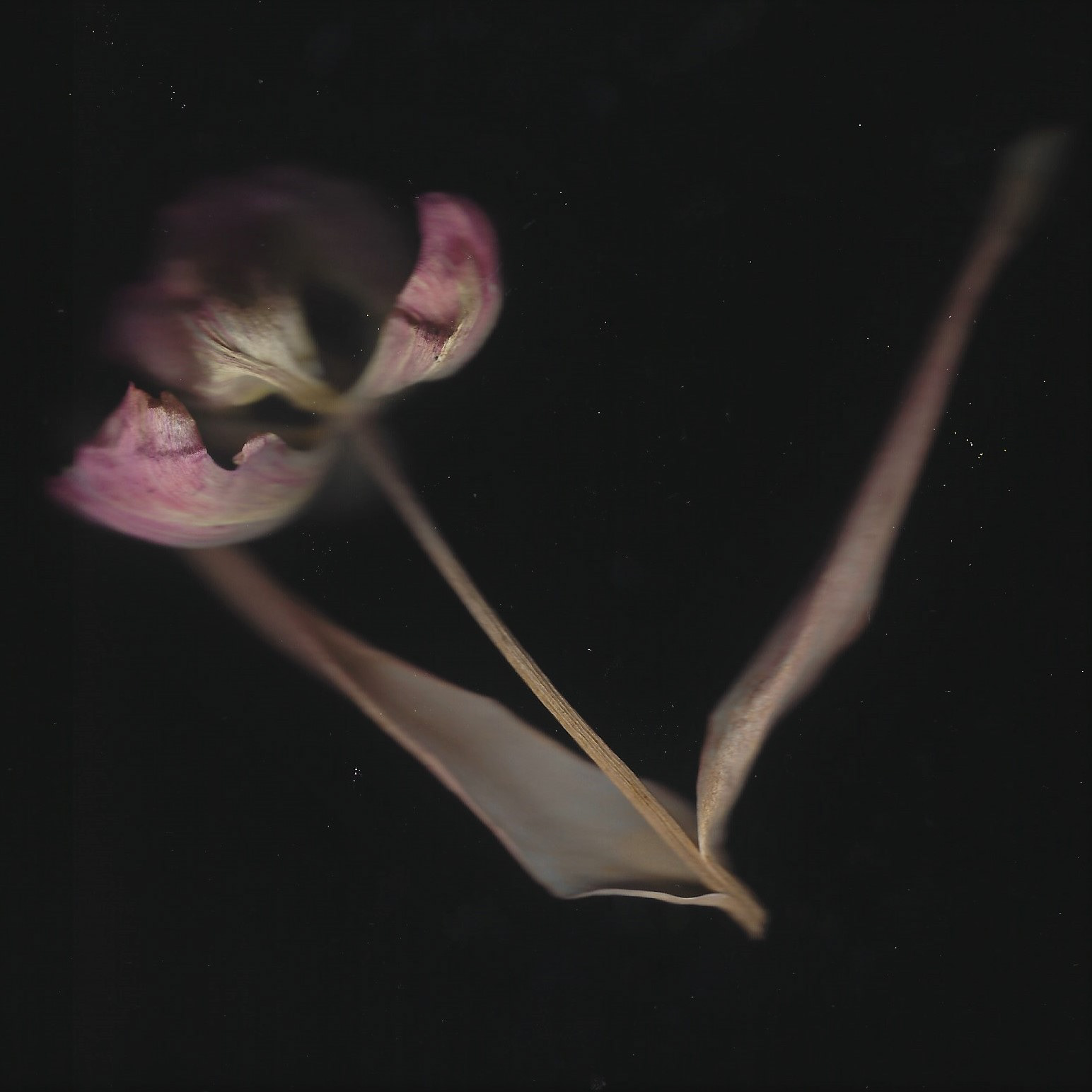 Tulip scan
