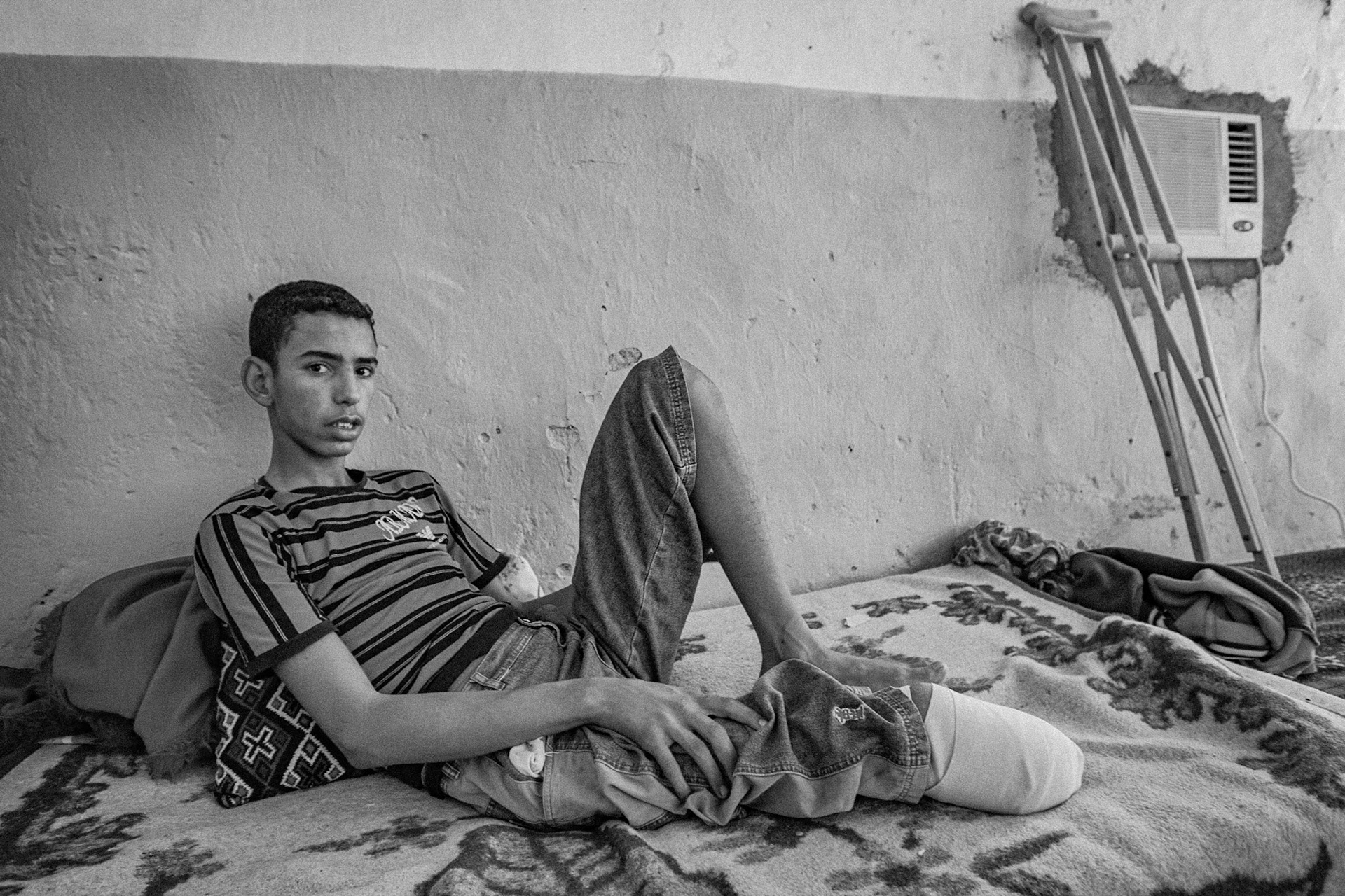 Dakhla refugee camp, Tindouf, Wilaya de Tindouf, Algerian Sahara, 2009: Brahim Houssein Abeidi, victim of a mine at the Wounded War Martir Cherif hospital.