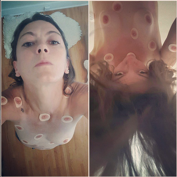 all over nipples