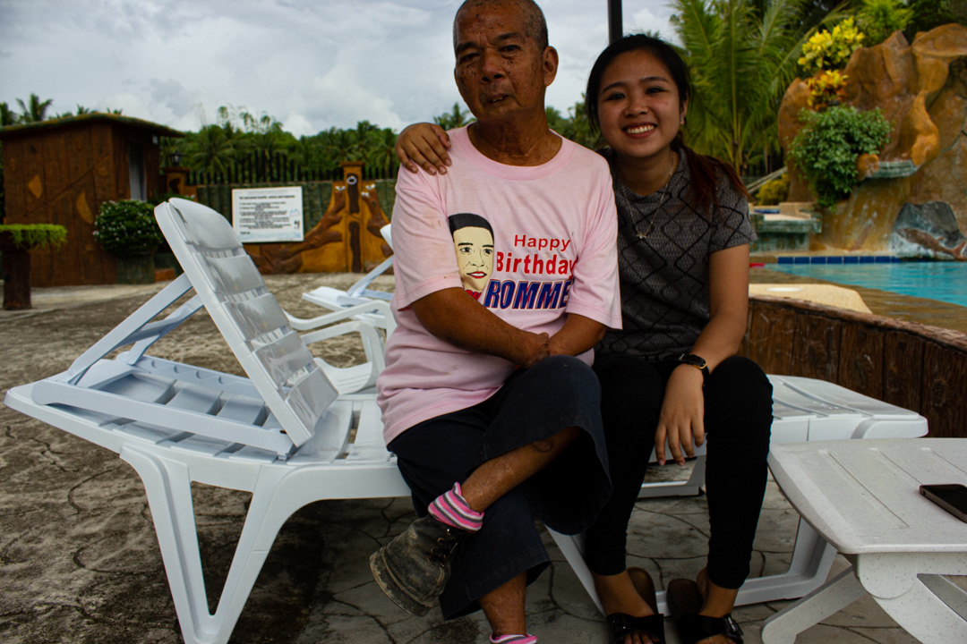 My mom’s uncle Ernesto was born without hands and feet. Leyte, Philippines.