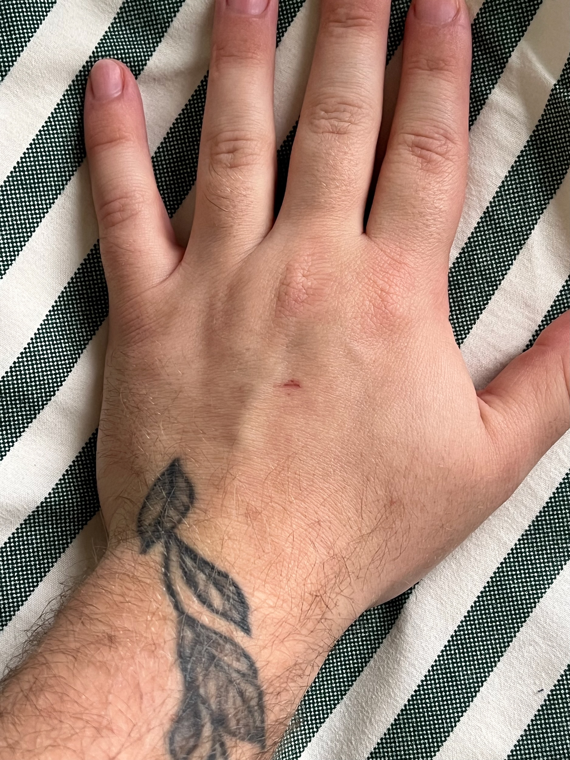 scratches as impermanent documentation