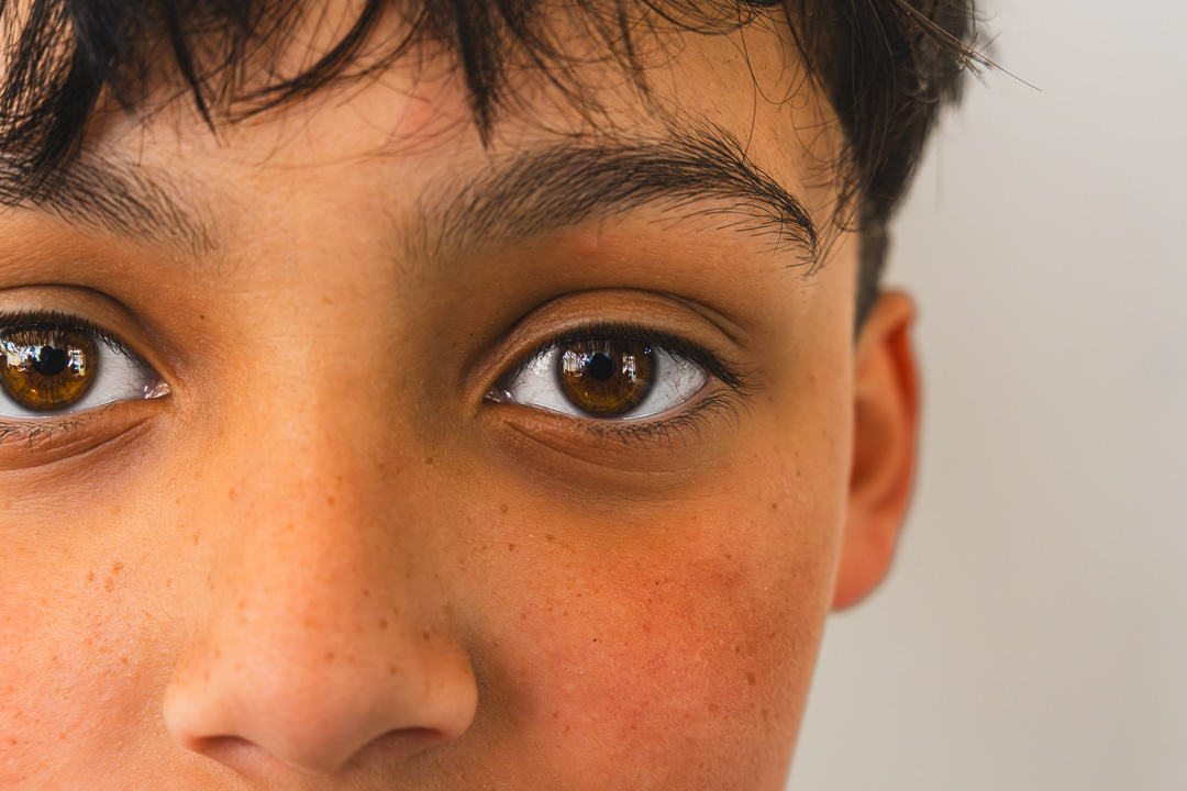  Primer plano de la cara de un niño. Se ven sus dos ojos, cejas, parte de la nariz y sus pecas. La mitad derecha del rostro está fuera de foco.
