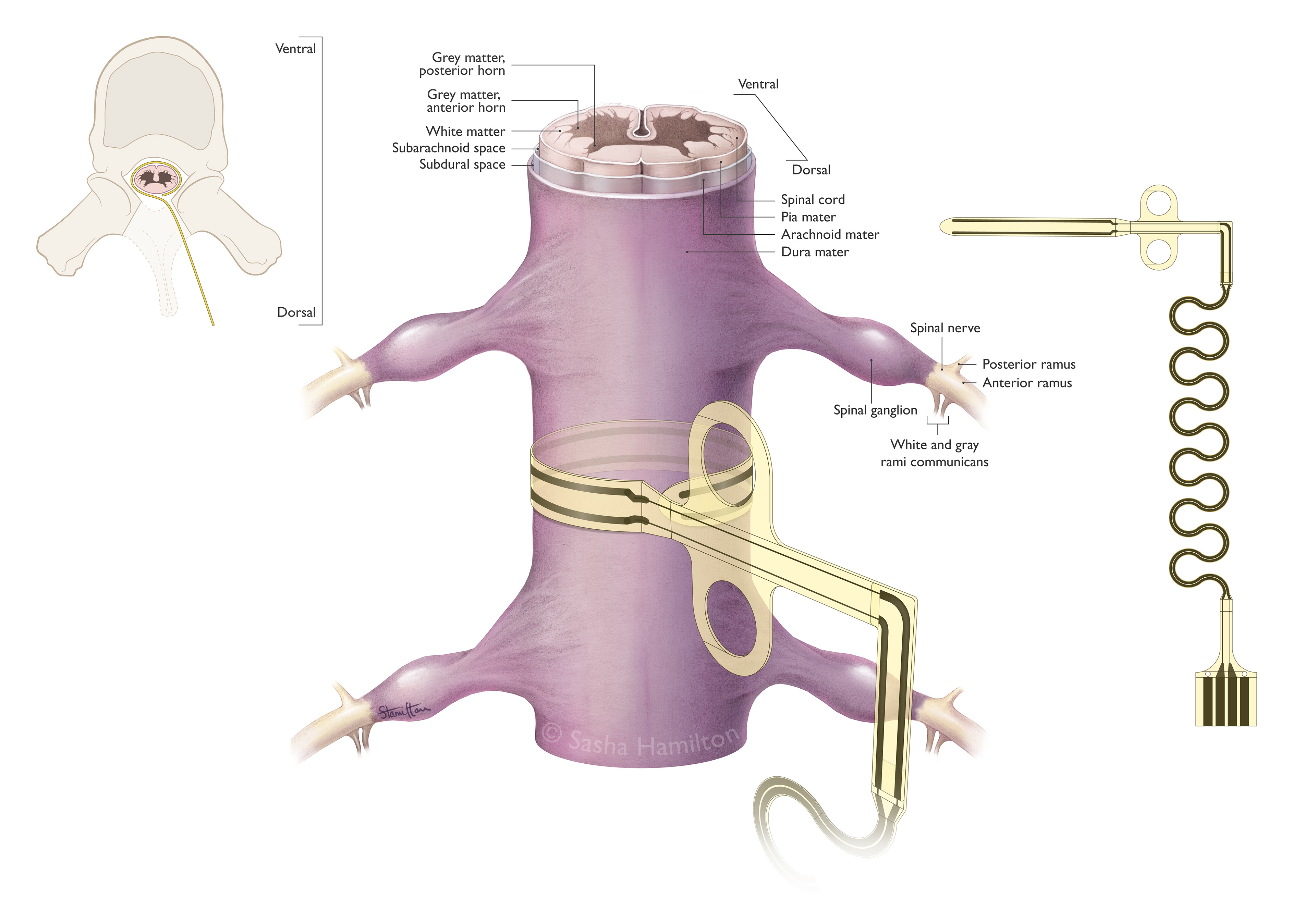 Illustration created as part of my master's thesis to visualize a flexible micro electrode wrapped around the spinal cord. Graphite pencil, Adobe Photoshop, Adobe Illustrator. 2024.