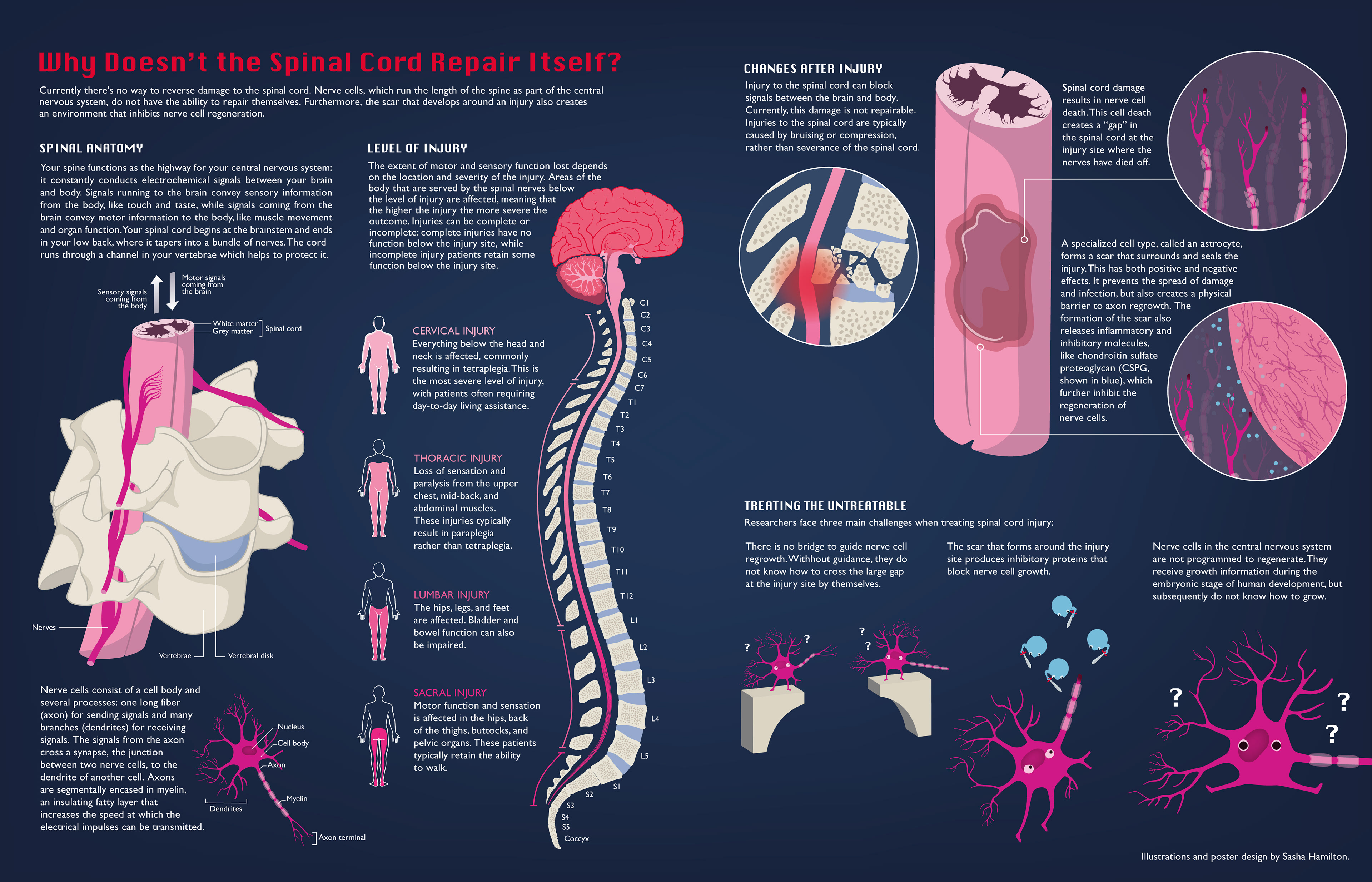 Educational poster created for my master’s thesis to address the question “why doesn’t the spinal cord repair itself?” for a general audience. Adobe Illustrator. 2024.