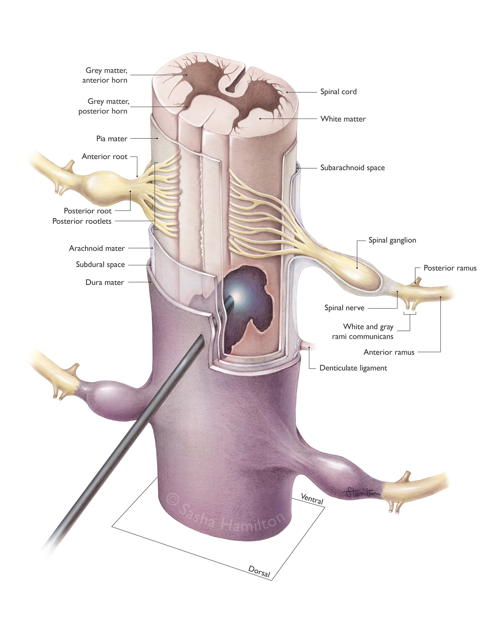 Illustration created as part of my master’s thesis to demonstrate setting an injectable material into the spinal cord with light. Graphite pencil, Adobe Photoshop,  Adobe Illustrator. 2024.