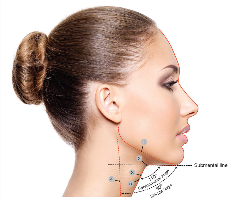 Ideal submental profile.V2