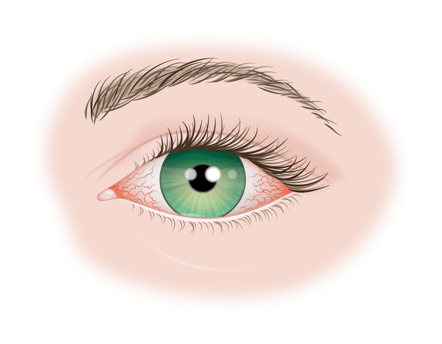 American College of Gastroenterology: Extraintestinal manifestations