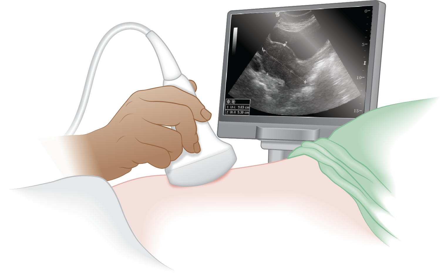 American College of Gastroenterology: Ultrasound