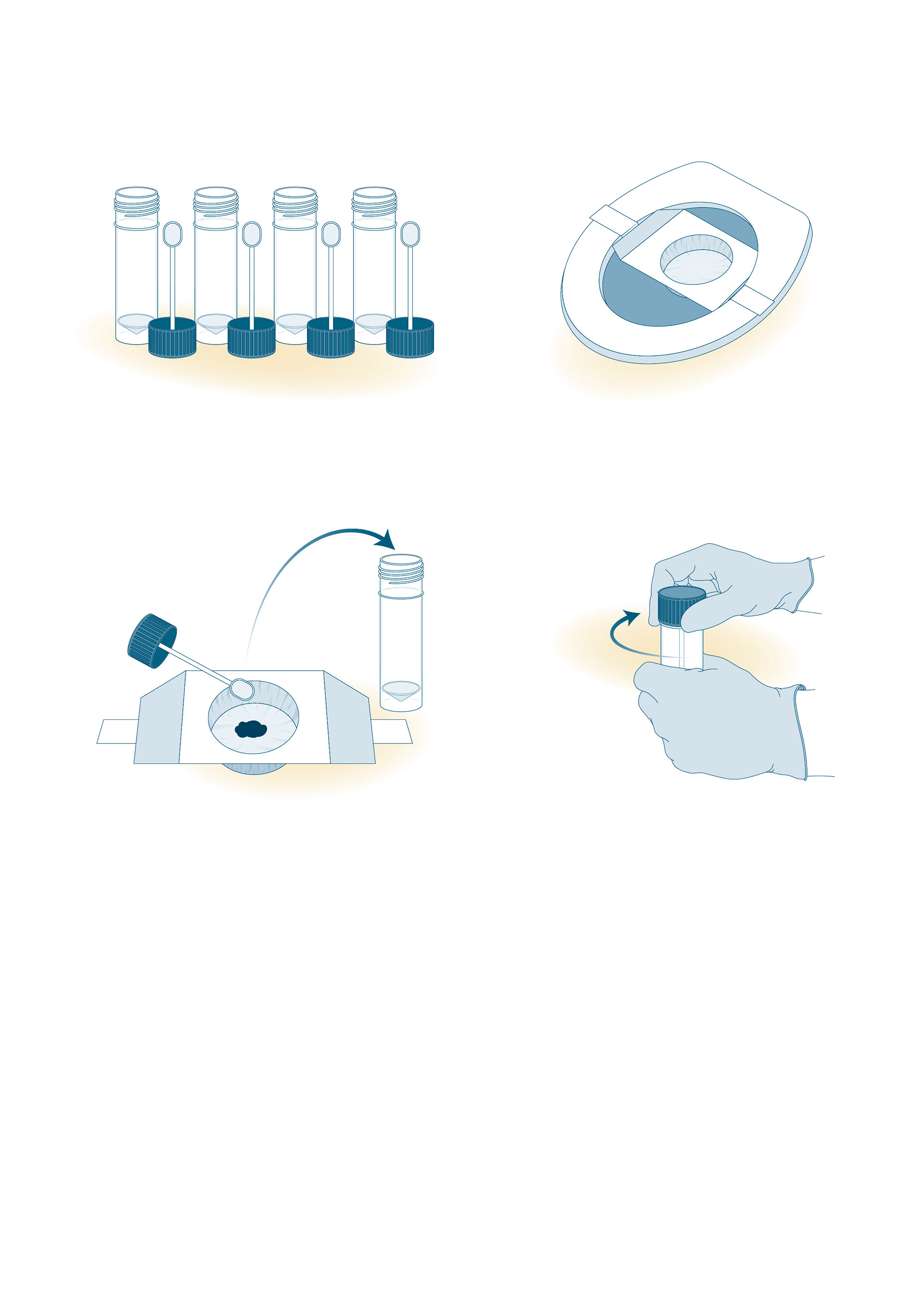 stool sample collection