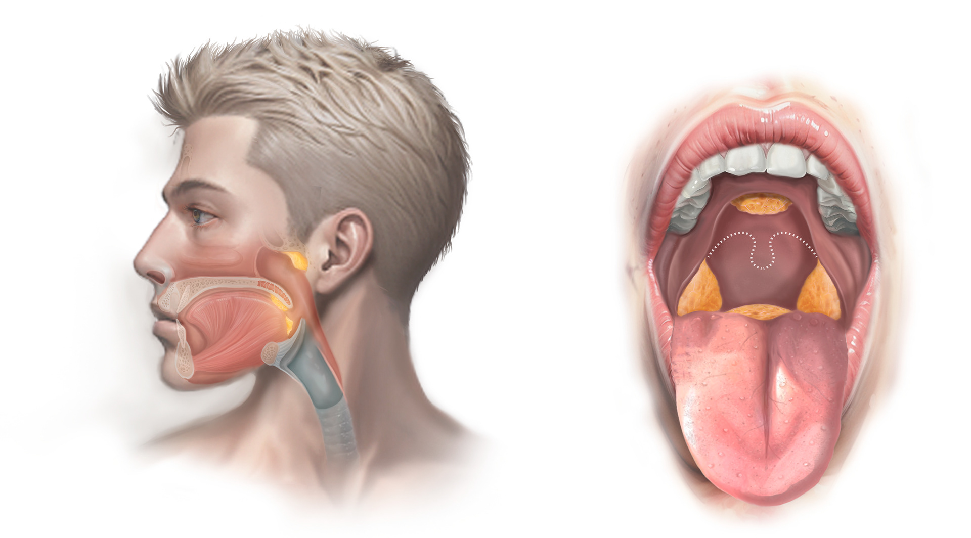 Tonsil anatomy