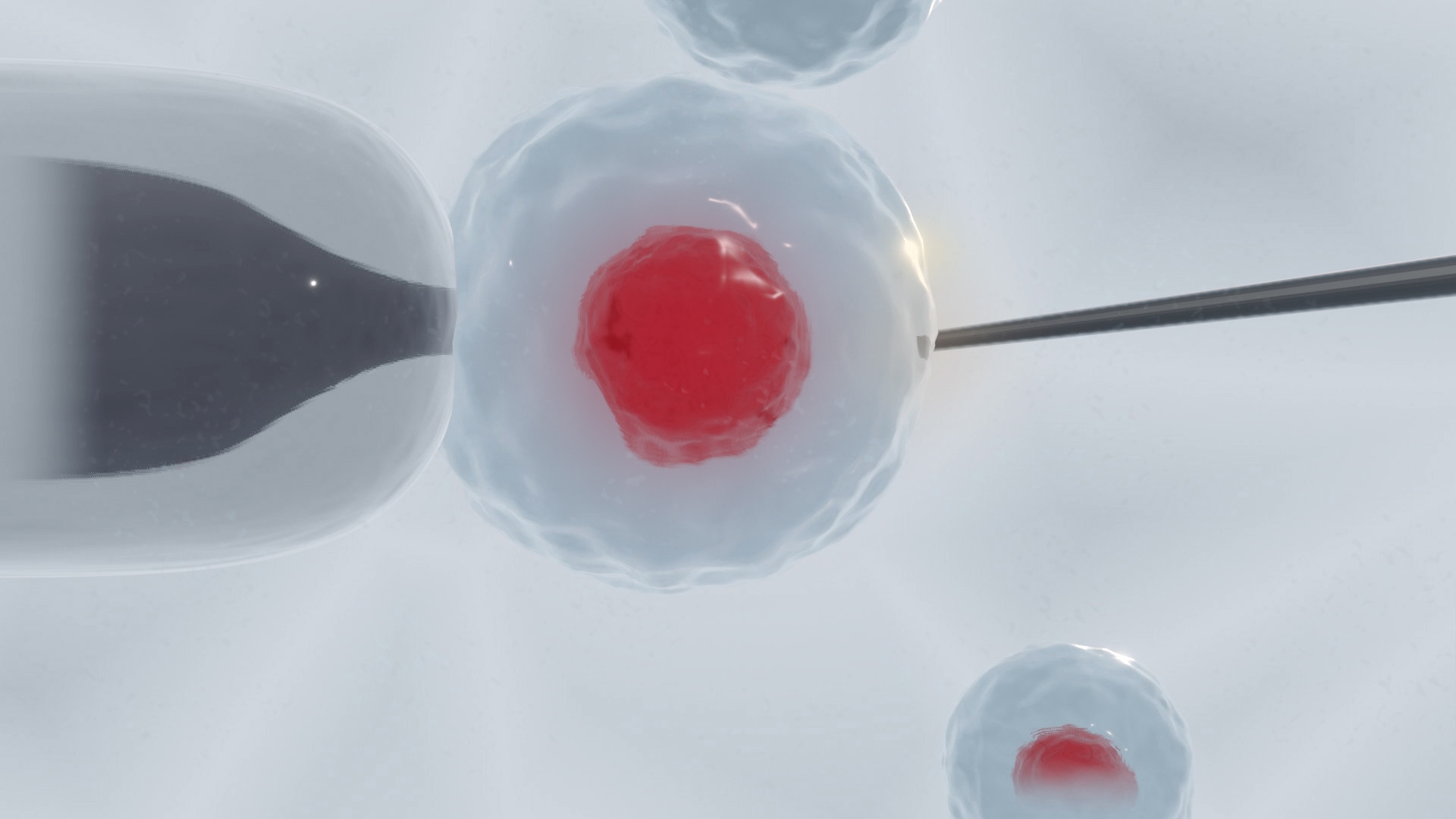 In vitro fertilization