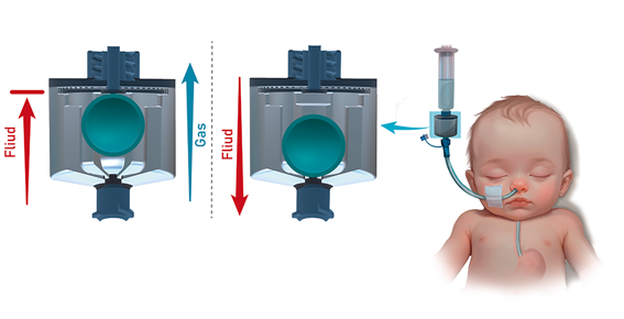 Infant Respiratory Support