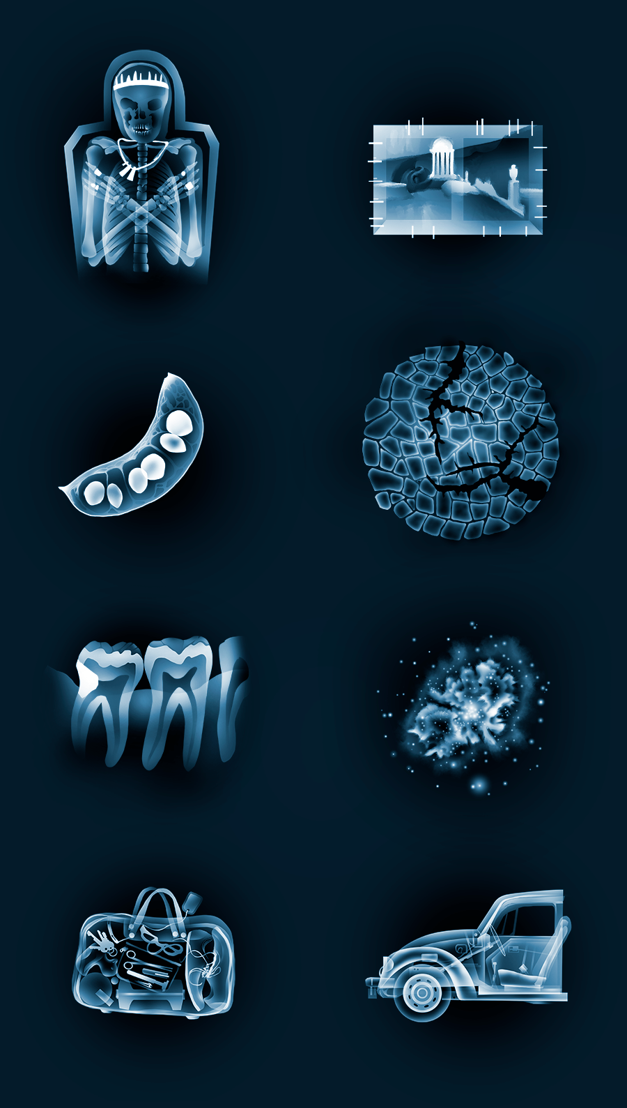 Illustrated application examples for X-rays