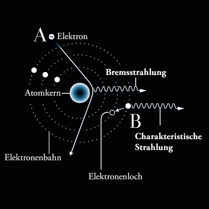 Two types of rays (german)