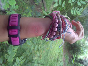 Swollen and in stinging feeling. Can anyone know why I had this?