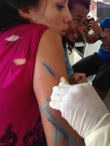 Clinic team cleaning my wound with alcohol 70%!