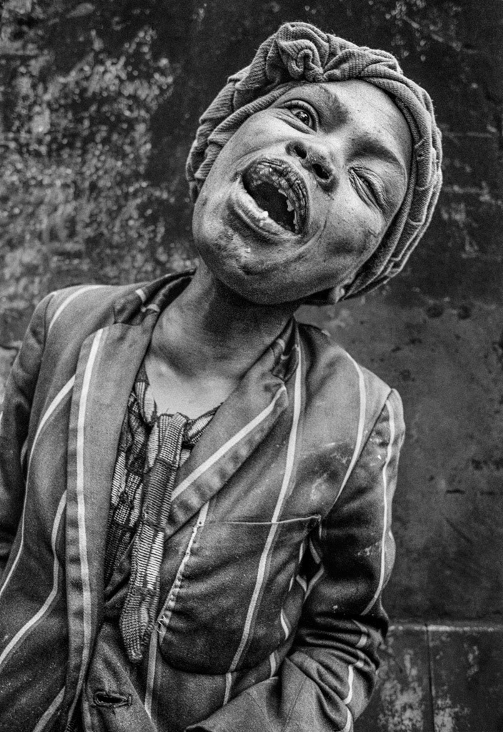 Woman collapses after drinking methylated spirits. Sea Point, 1976