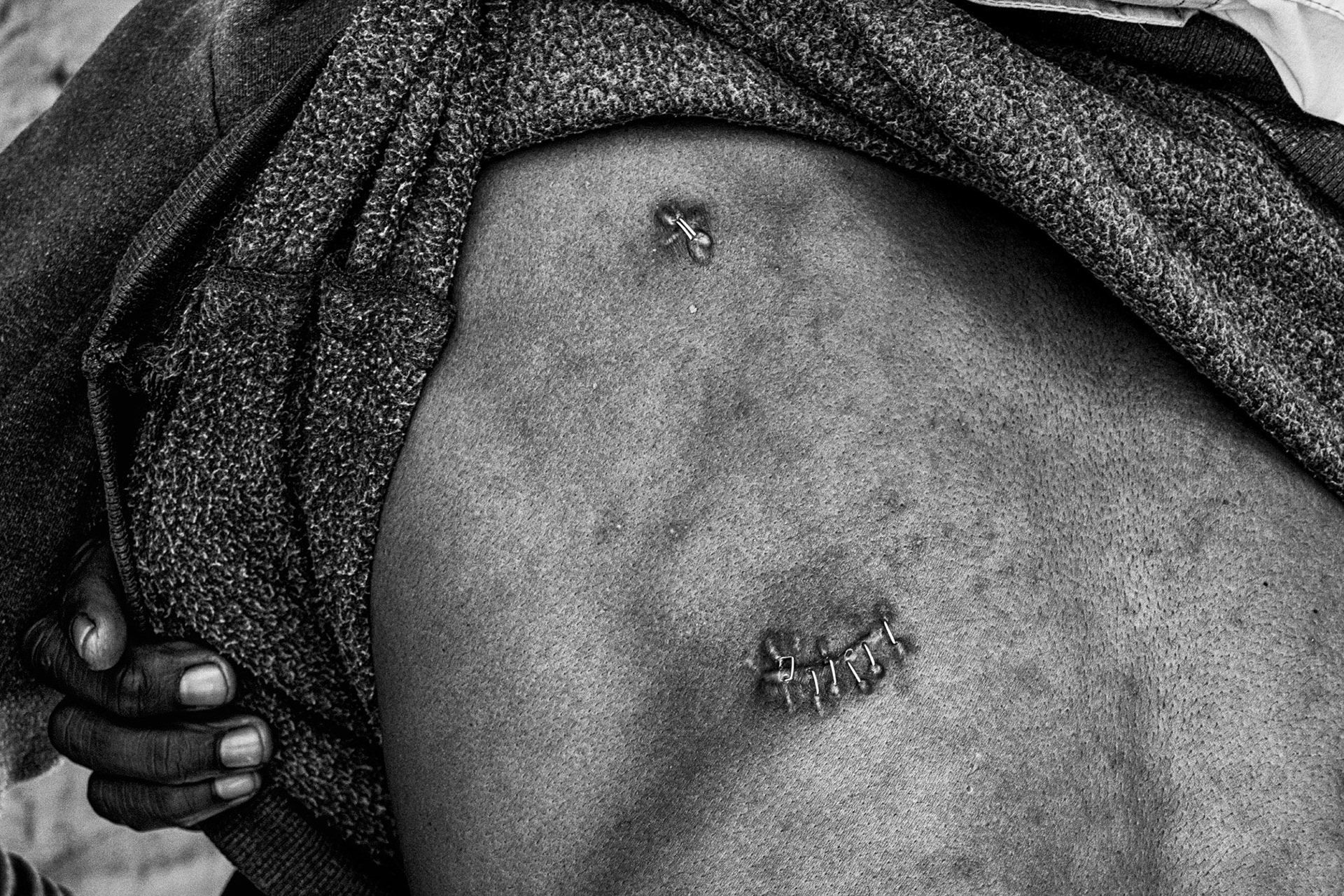 Stab wounds, Heudeveld