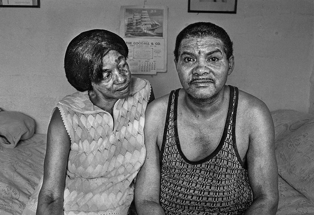 Stroke sufferer and his wife, shortly he fell ill. Manenberg, 1977.