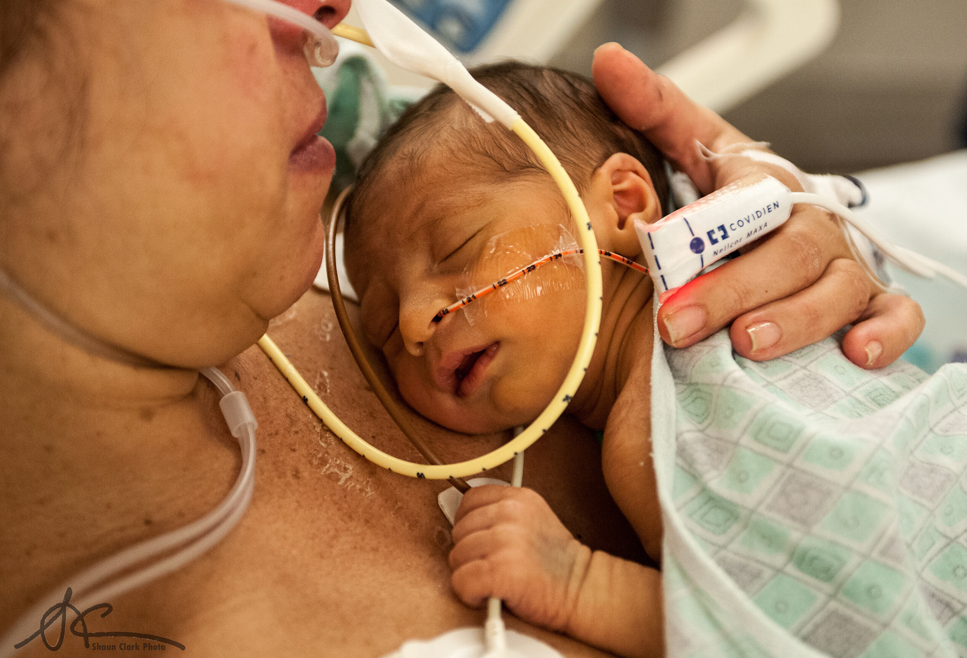 Day 11 - Visiting Mommy in the ICU.