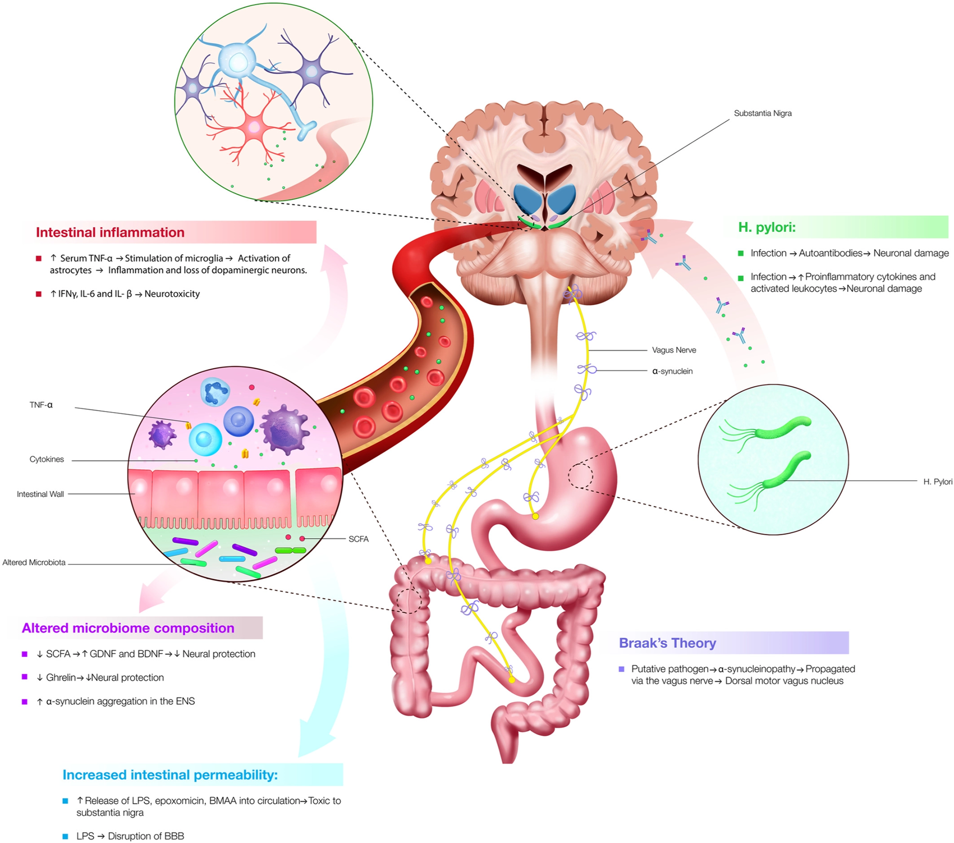 Serageldin Kamel, MD Artwork - Gut-Brain Axis