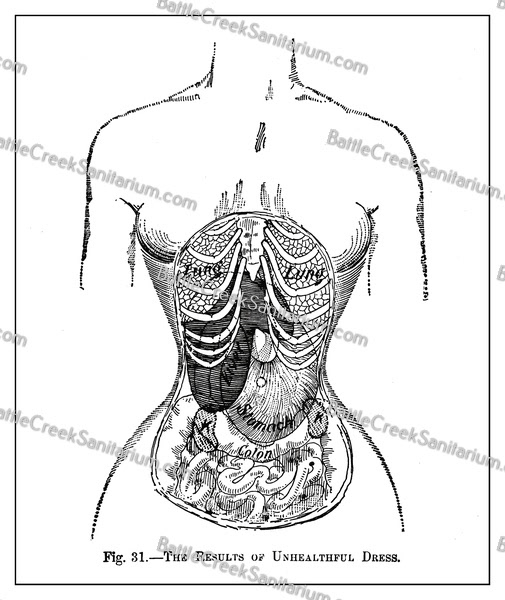 Misc-46 Dress reform Battle Creek Sanitarium